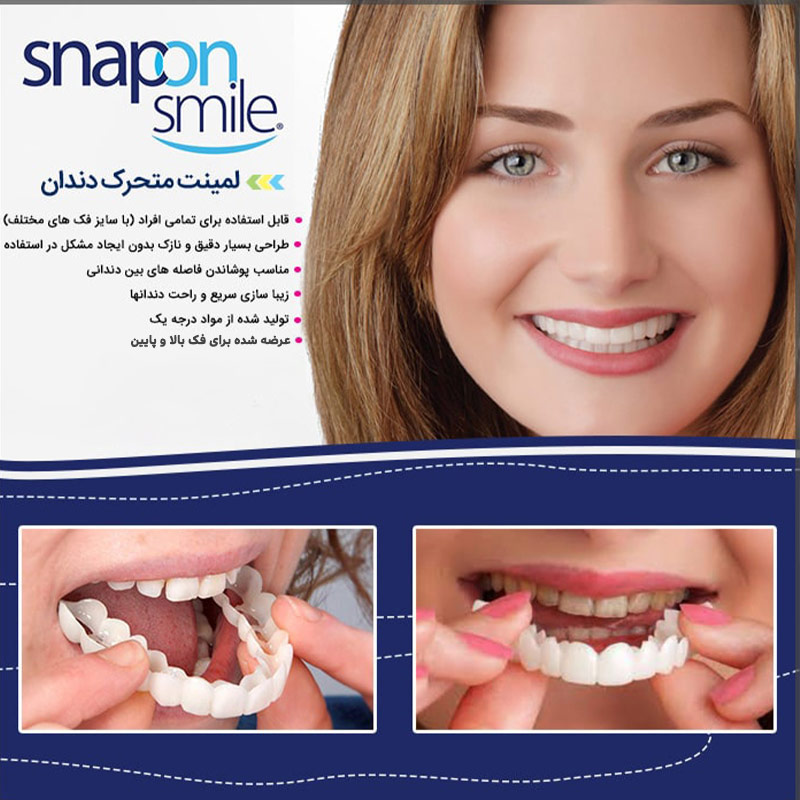 لمینت متحرک دندان اسنپ ان اسمایل Snap On Smile مشاهده قیمت و یا خرید اینجا کلیک کنید پرداخت وجه درب منزل ( برای همه شهرهای ایران )