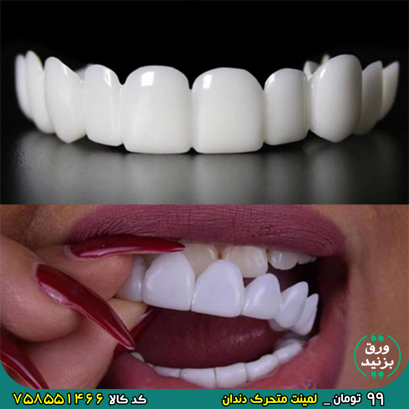 758551466 لمینت متحرک دندان برای خرید اینجا کلیک کنید 🎀 برای دیدن عکسهای بیشتر ورق بزنید 🎀
🔸 لمينت دندان مدل Big smile
🔸 دارای تاییدیه بهداشتی
🔸 طراحی بسیار دقیق و نازک بدون ایجاد مشکل در استفاده
🔸 مناسب پوشاندان فاصله های بین دندانی
🔸 تولید شده از جنس مواد پزشکی درجه یک
🔸 زیبا سازی سریع و راحت دندانها
🔸 لمینت دندان دوفک اسنپ Big smile 🔴 قیمت 99 هزار تومان
کد ۷۵۸۵۵۱۴۶۶ _ 758551466
کد ۳۲۳۴۷۸۲ _ 3234782
کد ۱۰۹۹۳۵۱ _ 1099351
