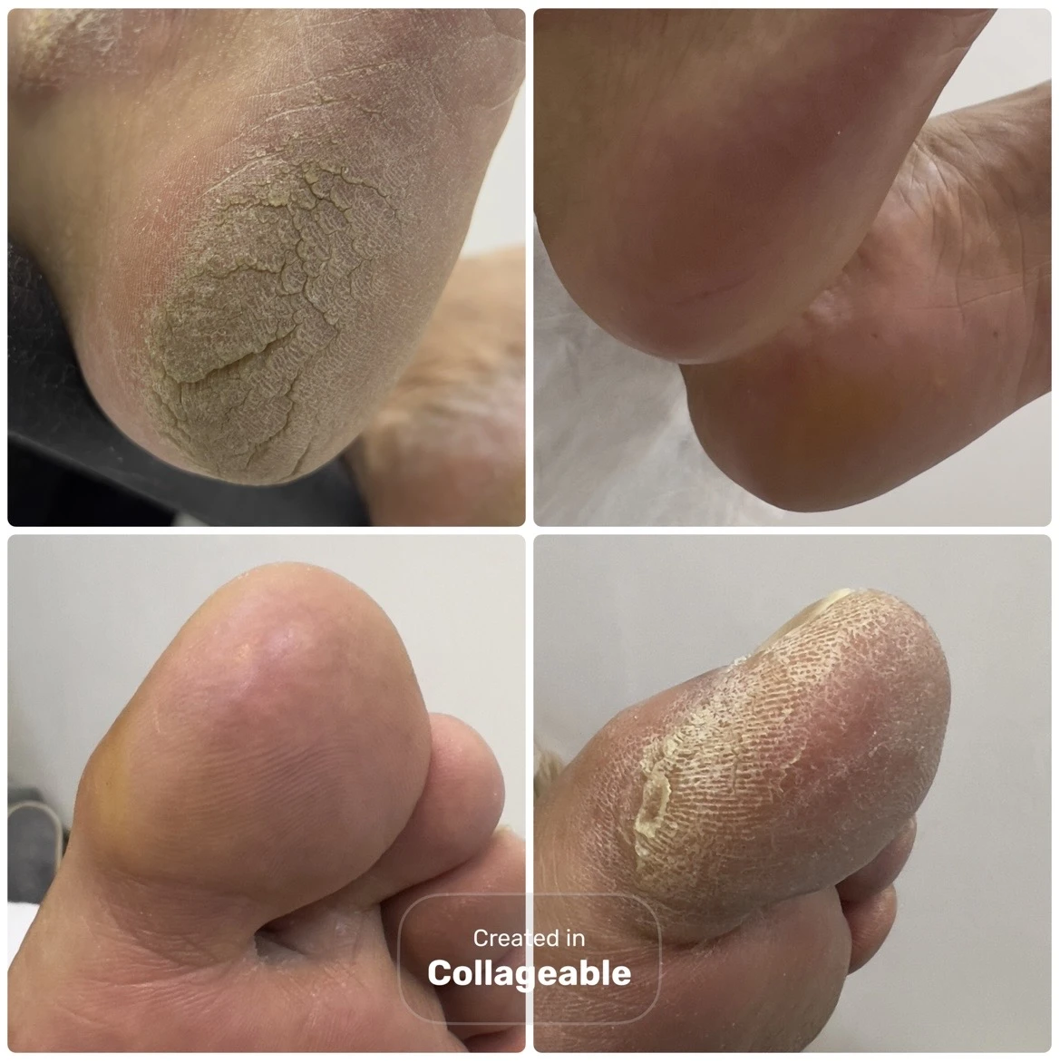 پدیکور، کفسابی پا، اسپا