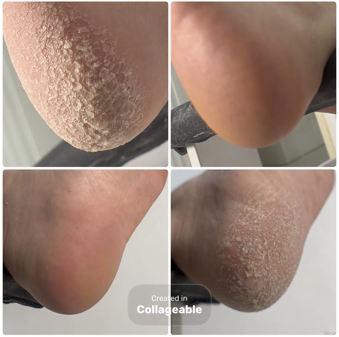 پدیکور، کفسابی پا، اسپا