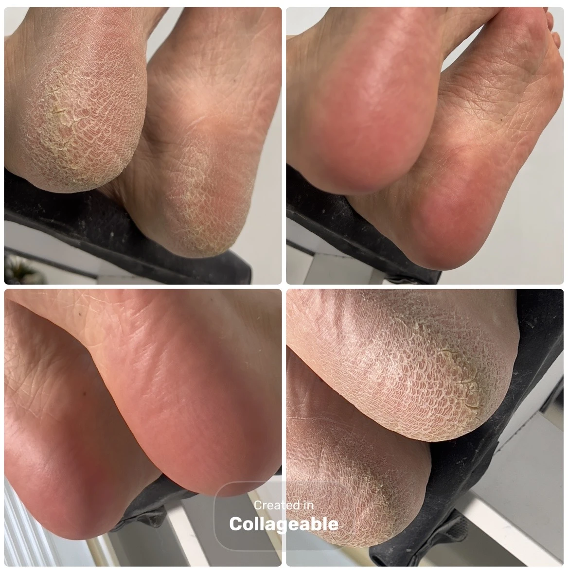 پدیکور، کفسابی پا، اسپا