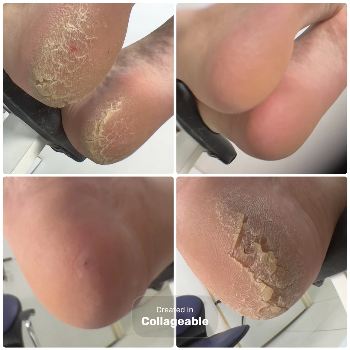 پدیکور، کفسابی پا، اسپا